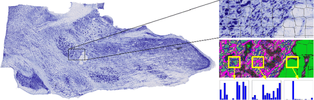 Figure 1 for Robust Landmark Detection for Alignment of Mouse Brain Section Images