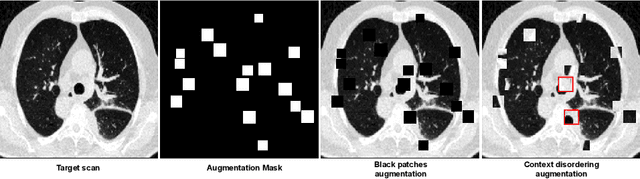 Figure 3 for Longitudinal Self-Supervision for COVID-19 Pathology Quantification