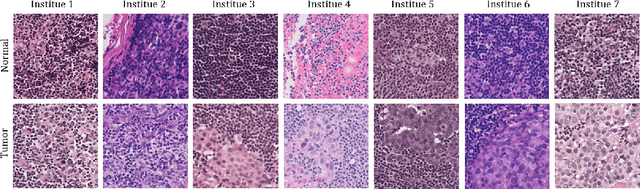 Figure 1 for Neural Stain-Style Transfer Learning using GAN for Histopathological Images