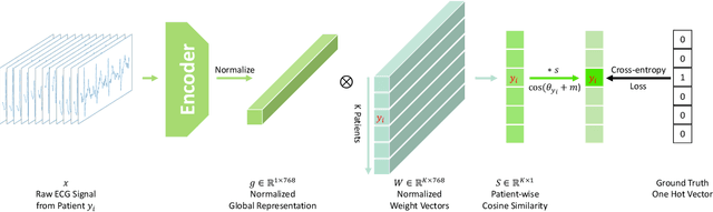 Figure 4 for Lead-agnostic Self-supervised Learning for Local and Global Representations of Electrocardiogram