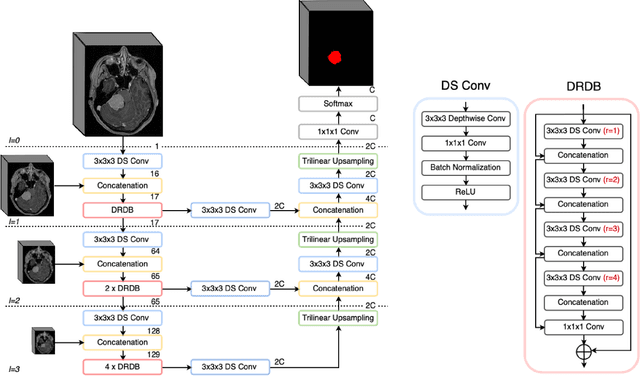 Figure 3 for Fast meningioma segmentation in T1-weighted MRI volumes using a lightweight 3D deep learning architecture