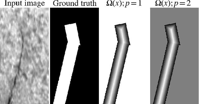 Figure 3 for End-to-end training of a two-stage neural network for defect detection