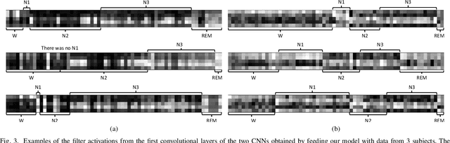 Figure 3 for DeepSleepNet: a Model for Automatic Sleep Stage Scoring based on Raw Single-Channel EEG