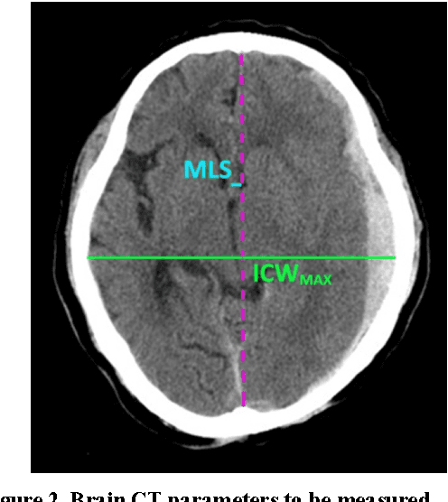 Figure 3 for A Simple, Fast and Fully Automated Approach for Midline Shift Measurement on Brain Computed Tomography