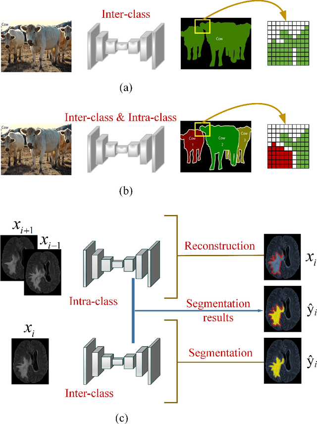 Figure 1 for EAA-Net: Rethinking the Autoencoder Architecture with Intra-class Features for Medical Image Segmentation