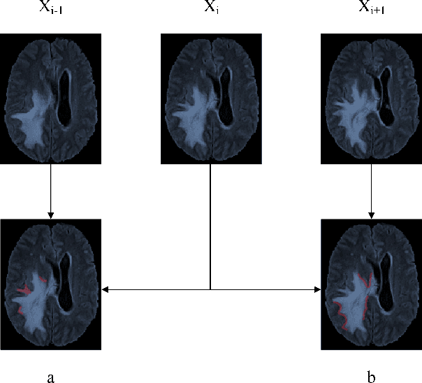 Figure 3 for EAA-Net: Rethinking the Autoencoder Architecture with Intra-class Features for Medical Image Segmentation
