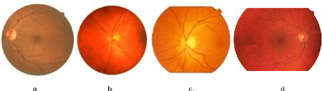 Figure 1 for SLAe-Net: Multi-Scale Multi-Level Attention embedded Network for Retinal Vessel Segmentation