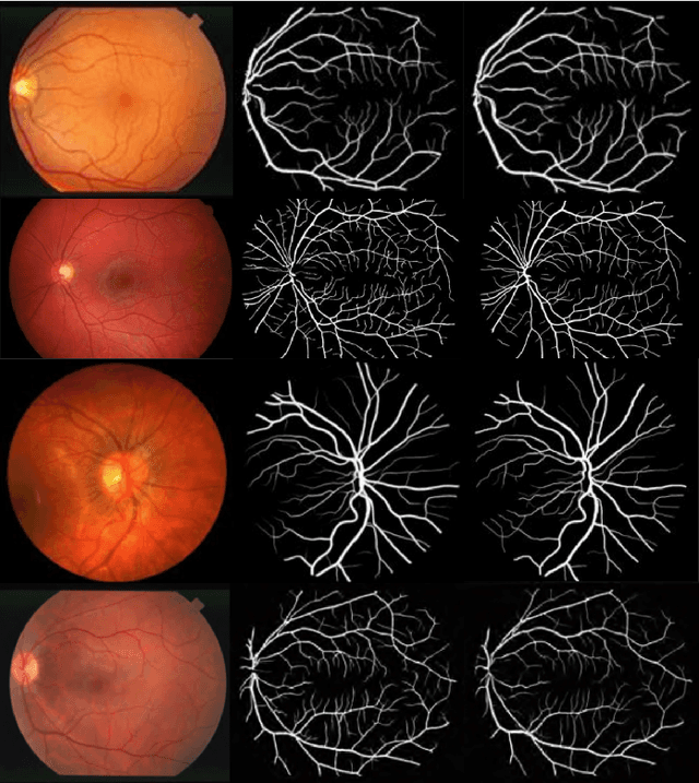 Figure 4 for SLAe-Net: Multi-Scale Multi-Level Attention embedded Network for Retinal Vessel Segmentation