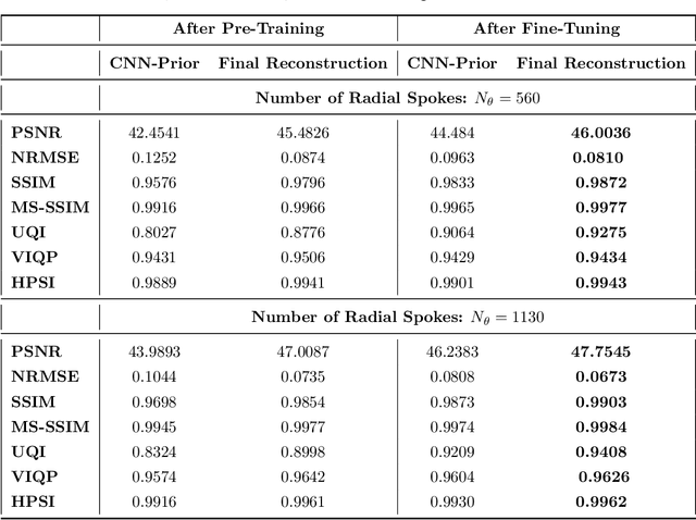 Figure 2 for An End-To-End-Trainable Iterative Network Architecture for Accelerated Radial Multi-Coil 2D Cine MR Image Reconstruction