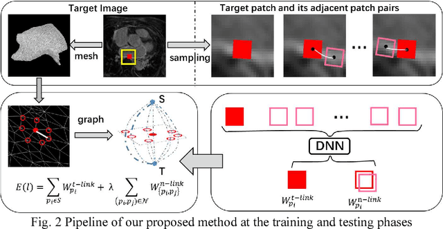 Figure 2 for Atrial scars segmentation via potential learning in the graph-cuts framework