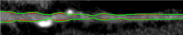 Figure 3 for Learning a sparse database for patch-based medical image segmentation