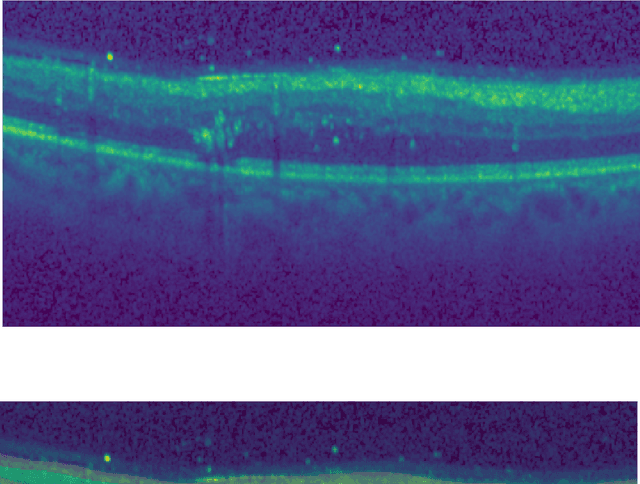 Figure 3 for Unsupervised cross domain learning with applications to 7 layer segmentation of OCTs