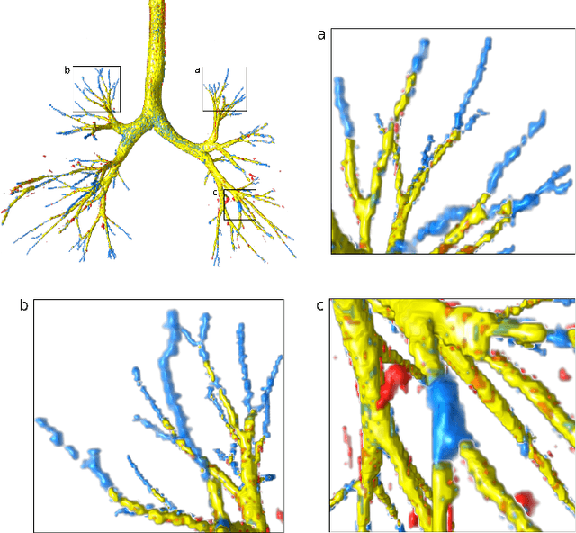 Figure 1 for Label Refinement Network from Synthetic Error Augmentation for Medical Image Segmentation