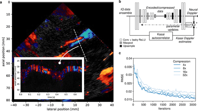 Figure 4 for Deep learning in ultrasound imaging