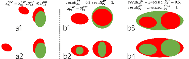 Figure 1 for The impact of using voxel-level segmentation metrics on evaluating multifocal prostate cancer localisation