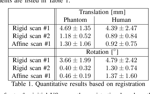 Figure 2 for Towards MRI-Based Autonomous Robotic US Acquisitions: A First Feasibility Study