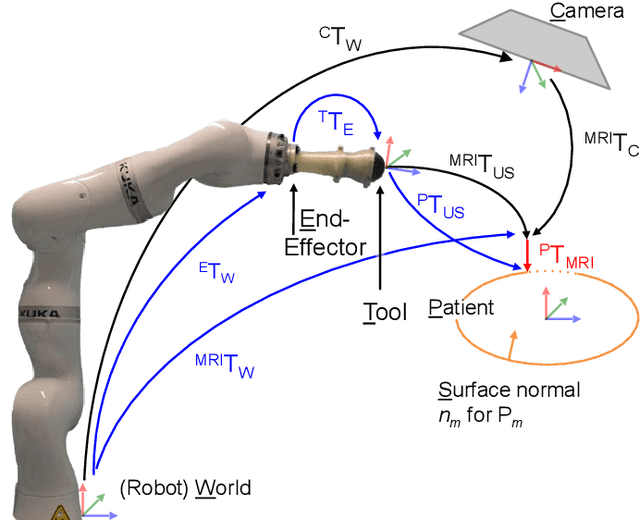 Figure 4 for Towards MRI-Based Autonomous Robotic US Acquisitions: A First Feasibility Study