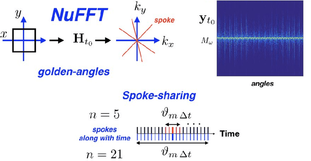 Figure 1 for Time-Dependent Deep Image Prior for Dynamic MRI