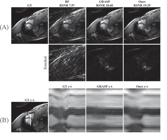 Figure 4 for Time-Dependent Deep Image Prior for Dynamic MRI