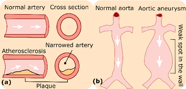 Figure 1 for Autonomous Robotic Screening of Tubular Structures based only on Real-Time Ultrasound Imaging Feedback