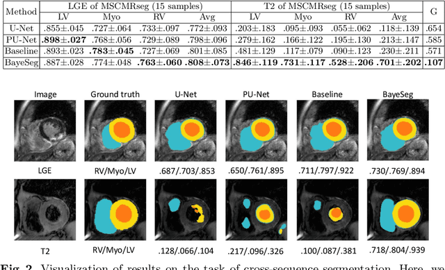 Figure 2 for Joint Modeling of Image and Label Statistics for Enhancing Model Generalizability of Medical Image Segmentation