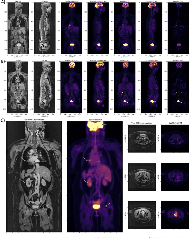 Figure 3 for Synthetic PET via Domain Translation of 3D MRI