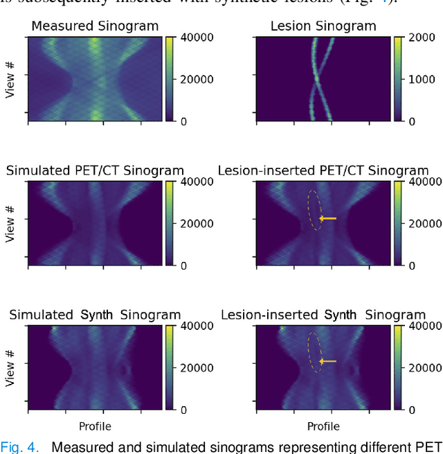 Figure 4 for Synthetic PET via Domain Translation of 3D MRI