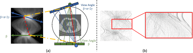 Figure 1 for Low-Dose CT Denoising via Sinogram Inner-Structure Transformer