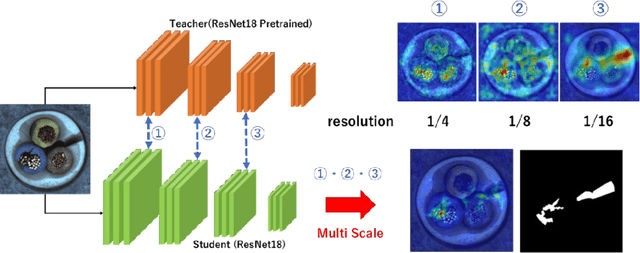 Figure 3 for Reconstruction Student with Attention for Student-Teacher Pyramid Matching