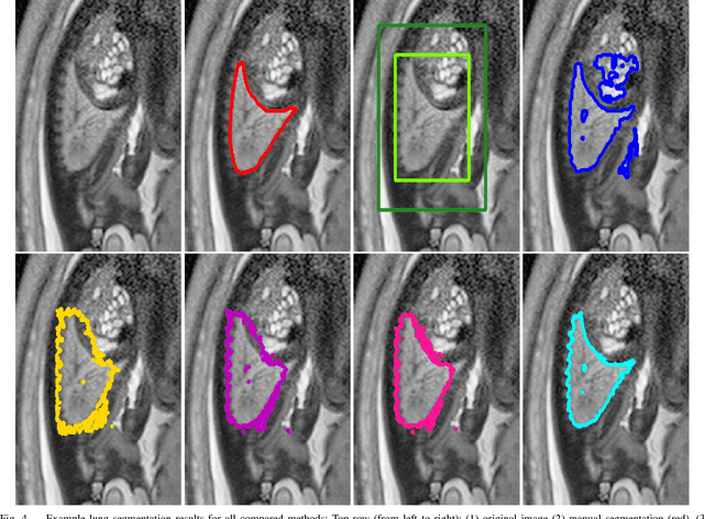 Figure 4 for DeepCut: Object Segmentation from Bounding Box Annotations using Convolutional Neural Networks