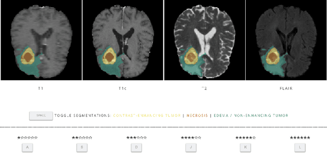 Figure 1 for Are we using appropriate segmentation metrics? Identifying correlates of human expert perception for CNN training beyond rolling the DICE coefficient