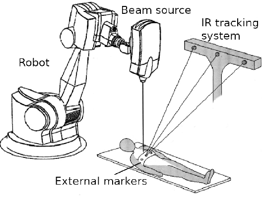 Figure 1 for Prediction of the Position of External Markers Using a Recurrent Neural Network Trained With Unbiased Online Recurrent Optimization for Safe Lung Cancer Radiotherapy