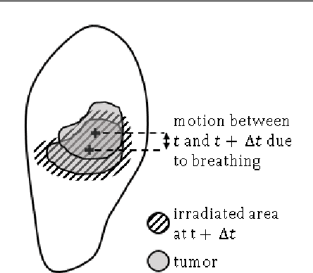 Figure 3 for Prediction of the Position of External Markers Using a Recurrent Neural Network Trained With Unbiased Online Recurrent Optimization for Safe Lung Cancer Radiotherapy