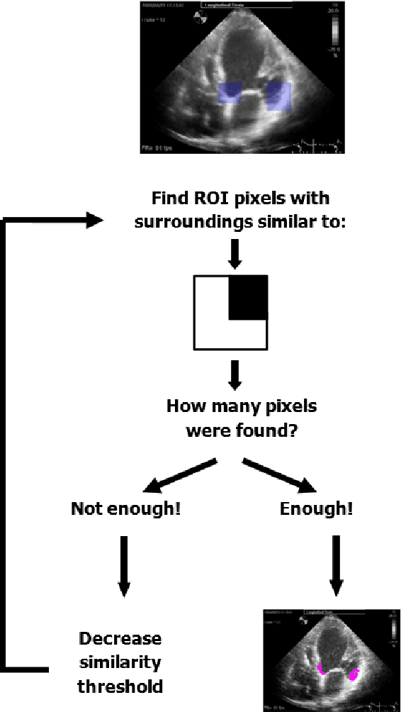 Figure 3 for Using Anatomical Markers for Left Ventricular Segmentation of Long Axis Ultrasound Images