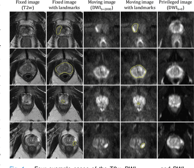 Figure 1 for Cross-Modality Image Registration using a Training-Time Privileged Third Modality