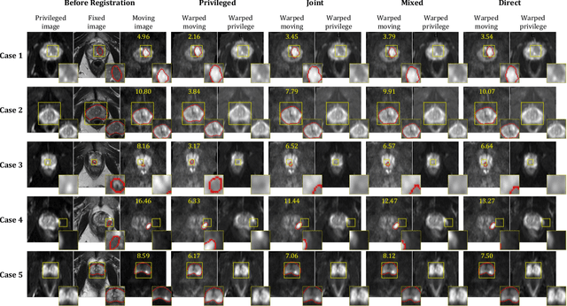 Figure 4 for Cross-Modality Image Registration using a Training-Time Privileged Third Modality