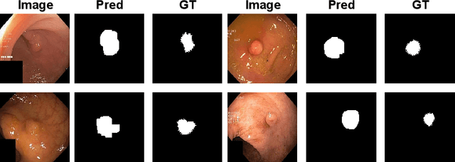 Figure 3 for Unsupervised Anomaly Detection in Medical Images with a Memory-augmented Multi-level Cross-attentional Masked Autoencoder