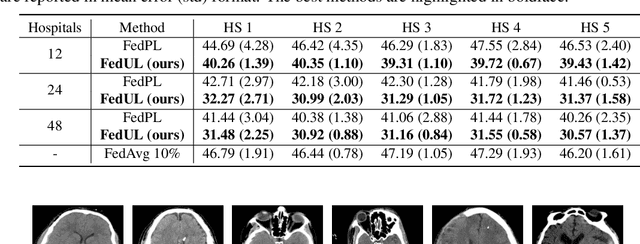 Figure 4 for Federated Learning from Only Unlabeled Data with Class-Conditional-Sharing Clients