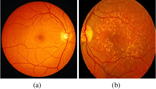 Figure 1 for retina-VAE: Variationally Decoding the Spectrum of Macular Disease