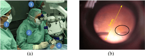 Figure 1 for Towards Robotic Eye Surgery: Marker-free, Online Hand-eye Calibration using Optical Coherence Tomography Images