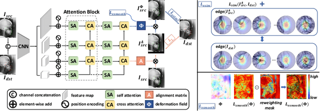 Figure 3 for One-Shot Medical Landmark Localization by Edge-Guided Transform and Noisy Landmark Refinement