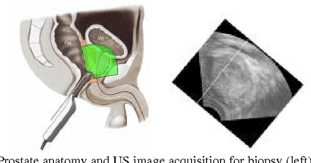 Figure 1 for BiopSym: a simulator for enhanced learning of ultrasound-guided prostate biopsy