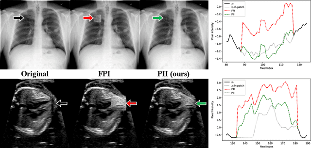 Figure 1 for Detecting Outliers with Poisson Image Interpolation