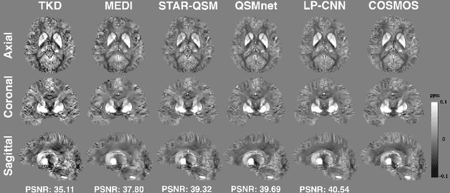 Figure 3 for Learned Proximal Networks for Quantitative Susceptibility Mapping
