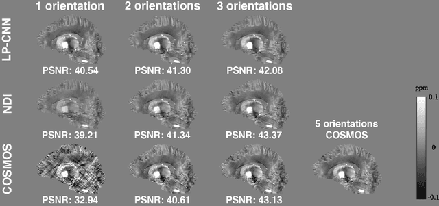 Figure 4 for Learned Proximal Networks for Quantitative Susceptibility Mapping