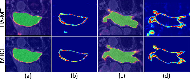 Figure 4 for A Multi-Task Cross-Task Learning Architecture for Ad-hoc Uncertainty Estimation in 3D Cardiac MRI Image Segmentation