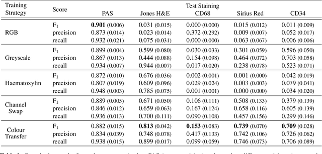 Figure 2 for Strategies for Training Stain Invariant CNNs