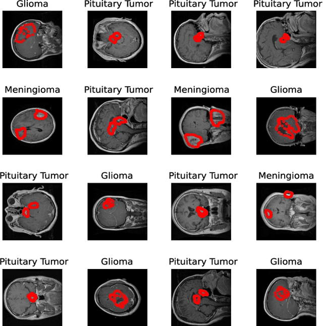 Figure 3 for What do Deep Neural Networks Learn in Medical Images?
