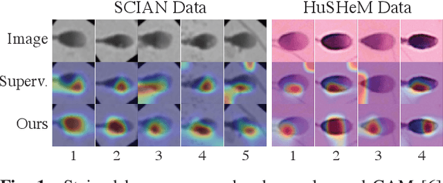 Figure 1 for Improving Human Sperm Head Morphology Classification with Unsupervised Anatomical Feature Distillation