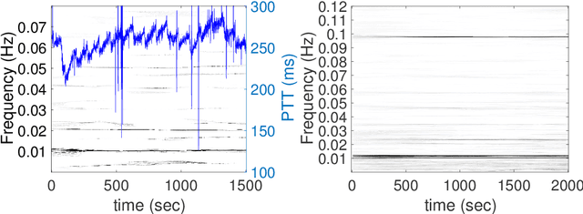 Figure 3 for Calibration for massive physiological signal collection in hospital -- Sawtooth artifact in beat-to-beat pulse transit time measured from patient monitor data